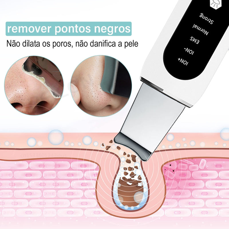 Esfoliante de Rosto Elétrico - Peeling Ultrassônico + Brinde