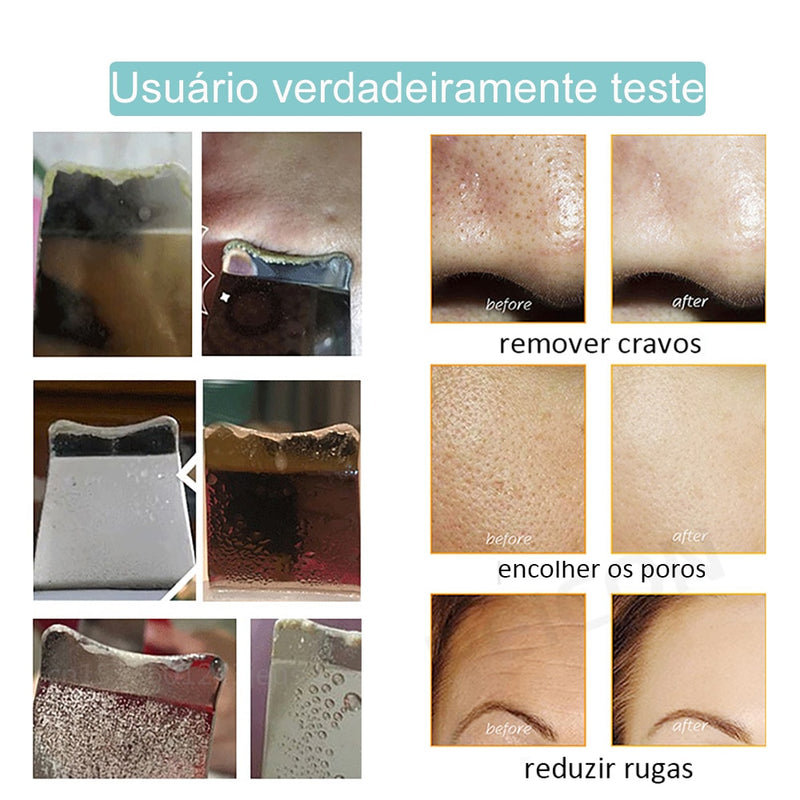 Esfoliante de Rosto Elétrico - Peeling Ultrassônico + Brinde