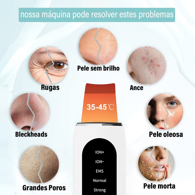 Esfoliante de Rosto Elétrico - Peeling Ultrassônico + Brinde